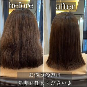 before-after